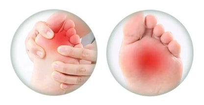 1/2Pair Silicone Pads Forefoot for Women's Shoes Non - slip Insert Self - adhesive Heel Gel Insoles Heels Sandals Anti - Slip Foot Pad - FastZen
