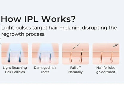 New Permanent IPL Laser Hair Removal Device – Unisex Epilator for Face &amp; Body, Electric Shaver Alternative - FastZen