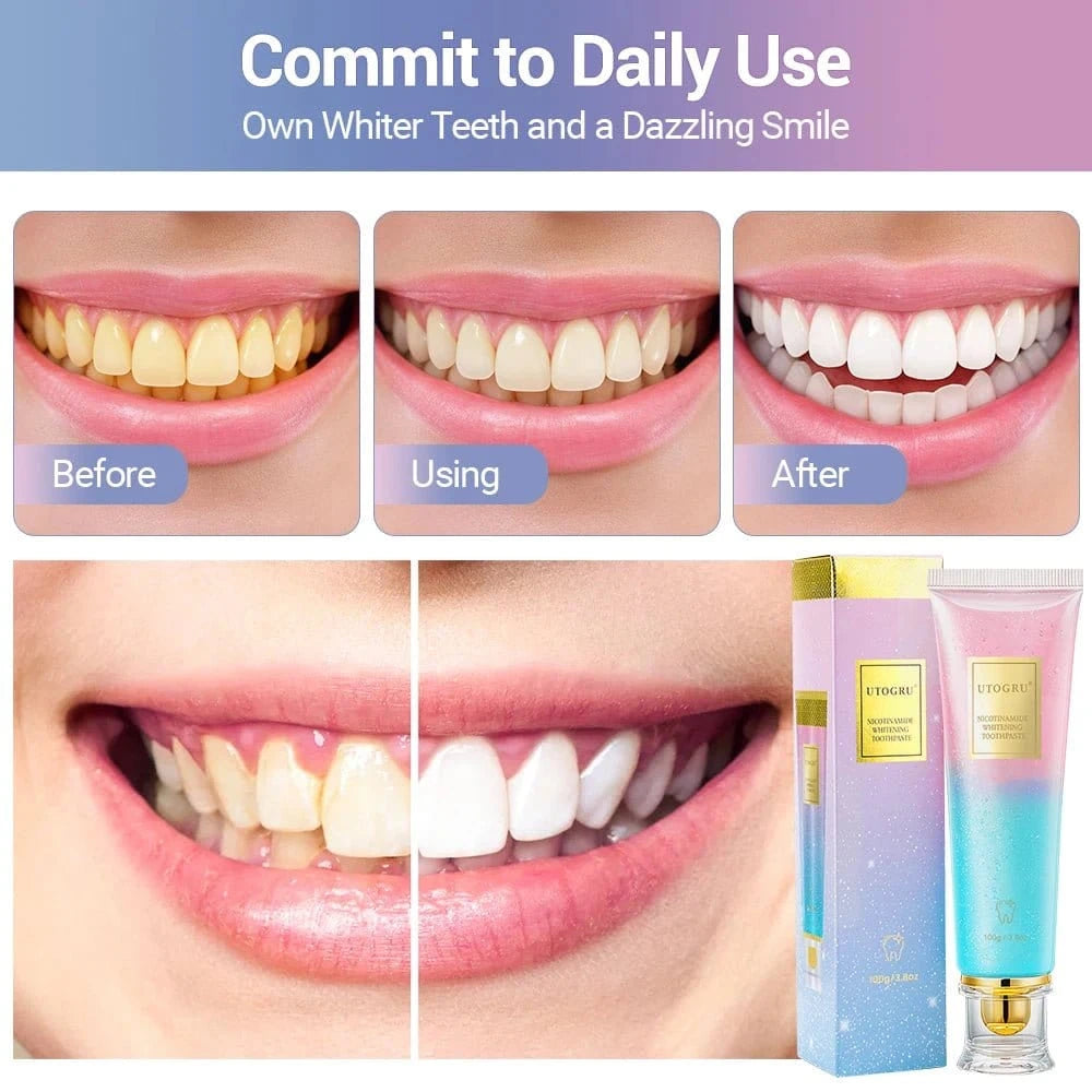 Whitening Toothpaste with Nicotinamide – Plaque & Stain Remover, Fresh Breath - FastZen